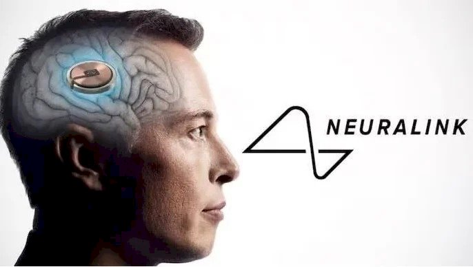 Neuralink de Elon Musk avança com primeiro implante cerebral em humano