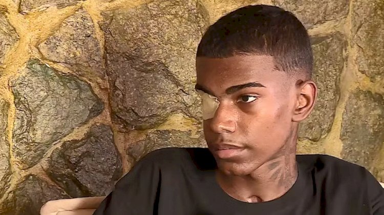 Estudante que perdeu a visão de um olho ao ser atropelado por trem a caminho da escola recebe alta após 3 meses: 'Milagre', diz pai