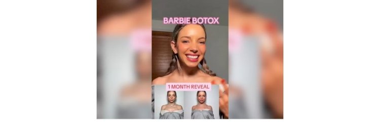 Médicos denunciam ‘botox da Barbie’, que pode deixar paciente sem conseguir levantar a cabeça